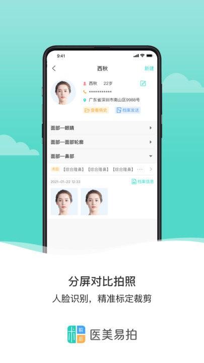 医美易拍软件下载,医美易拍,拍照app