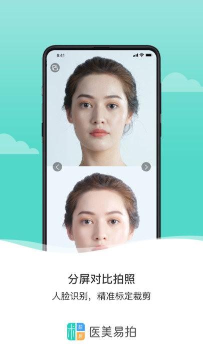 医美易拍软件下载,医美易拍,拍照app